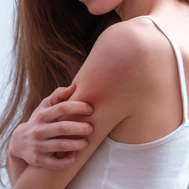 Sensitive skin