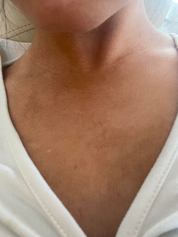 Tan and uneven tone